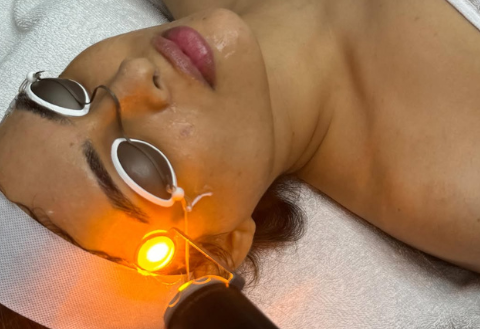 Benefits of Laser Hair Removal