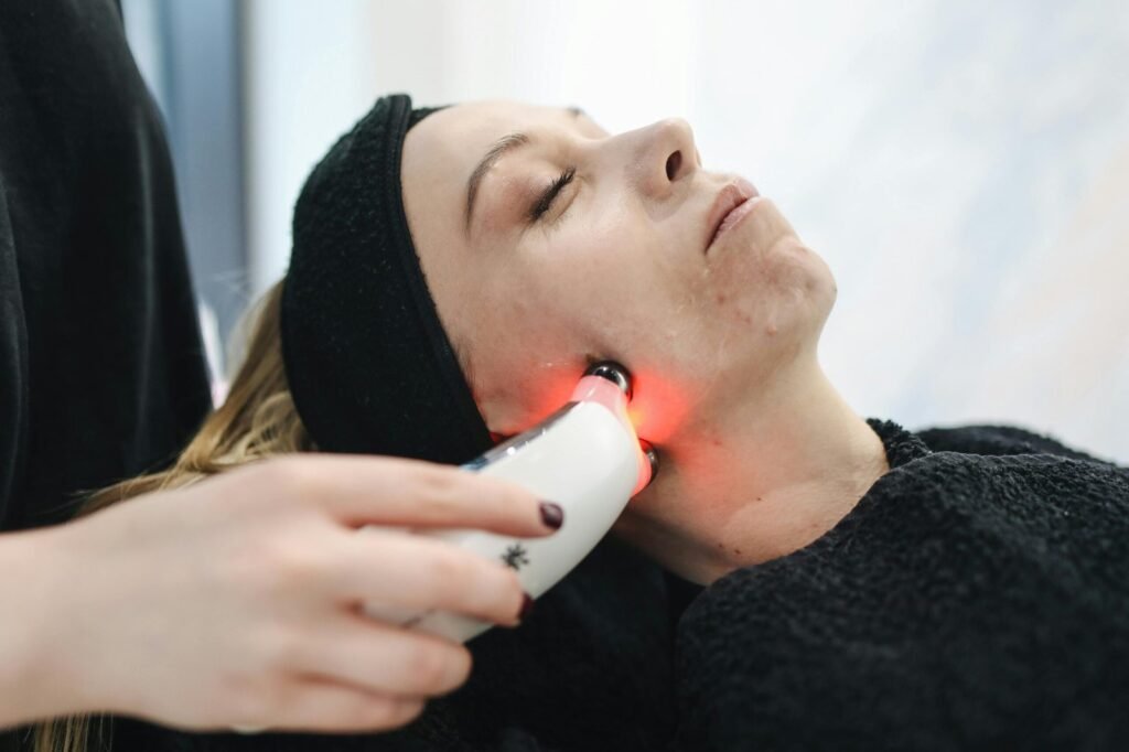acne marks removal