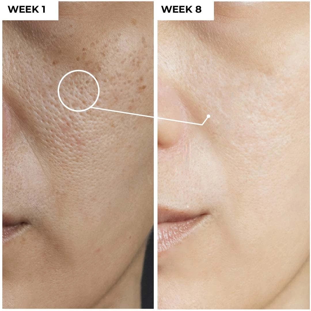niacinamide