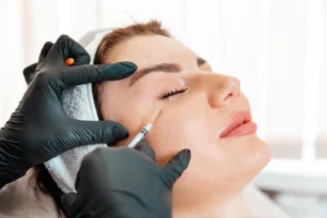 Procedure