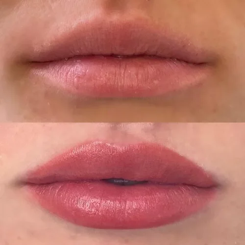 Lip blush