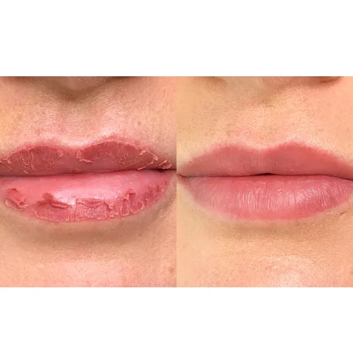 Lip Blush