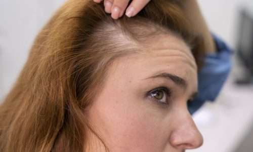 woman-getting-hair-loss-treatment-clinic